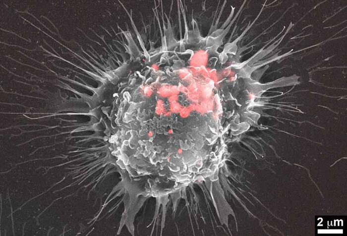 Makrofag fotografert med kryoelektronmikroskopi
